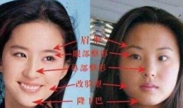 刘亦菲爆料整容视频,揭秘明星美容背后的秘密